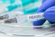 Sabah authorities tackle measles outbreak in Penampang