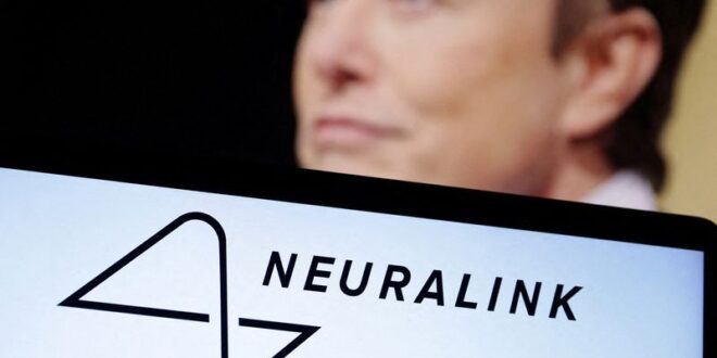 Want details on Elon Musks brain implant trial Youll have