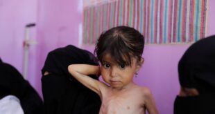 Malnutrition worsening in Yemens government controlled areas UN says