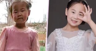 Stepmothers unconditional love transforms lice infected China girl into confident youngster